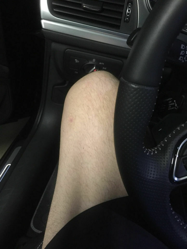 Der Lichtschalter und das Knie