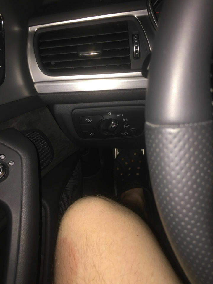 Der Lichtschalter und das Knie