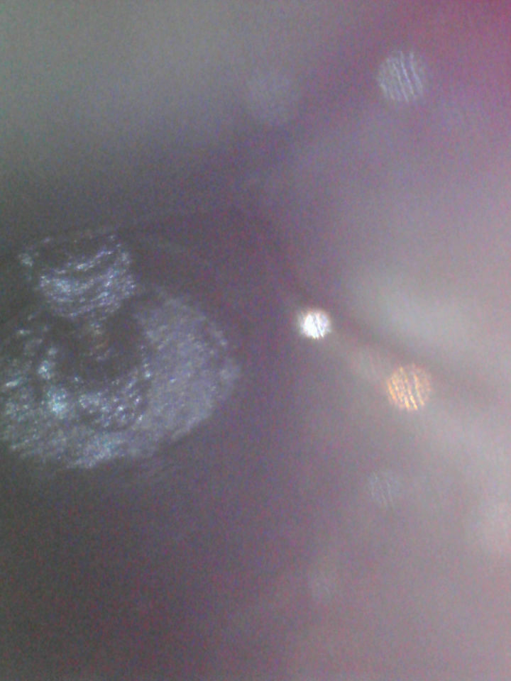 A4 B7 2.0 TFSI BWE - Leerlauf Rucken