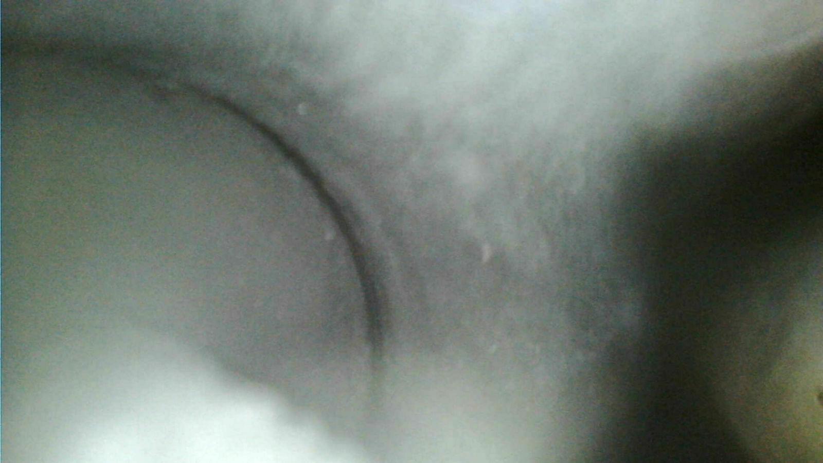 2,0 TFSI - Einspritzdüse undicht