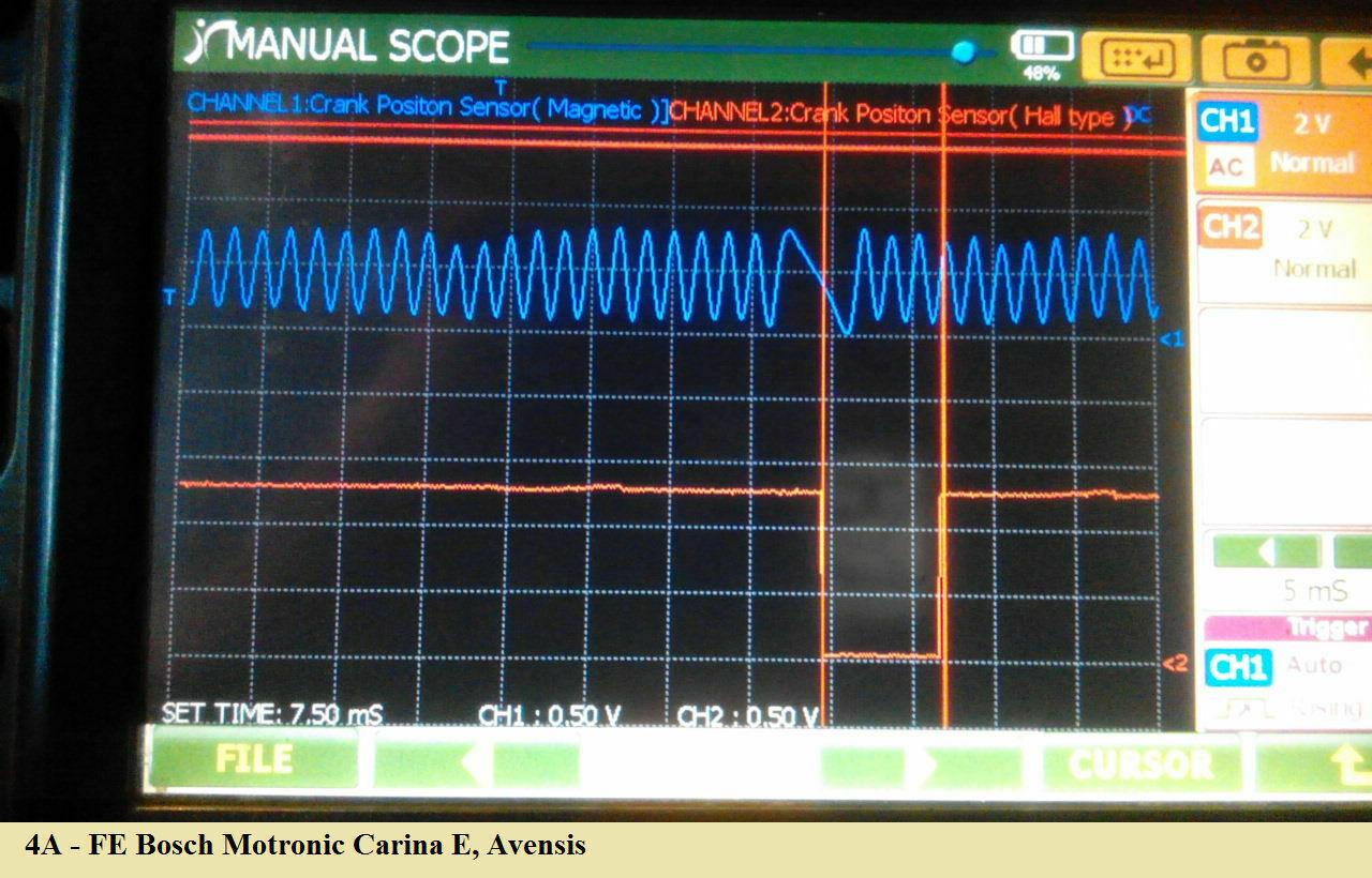 Omega B - X25DT - AGR-Ventil verursacht Motorschaden
