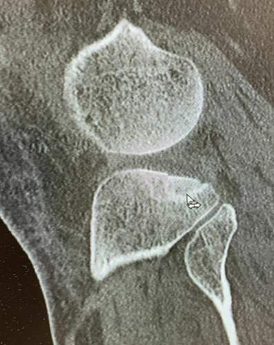 Bildschirmfoto-2022-03-17-um-11-15