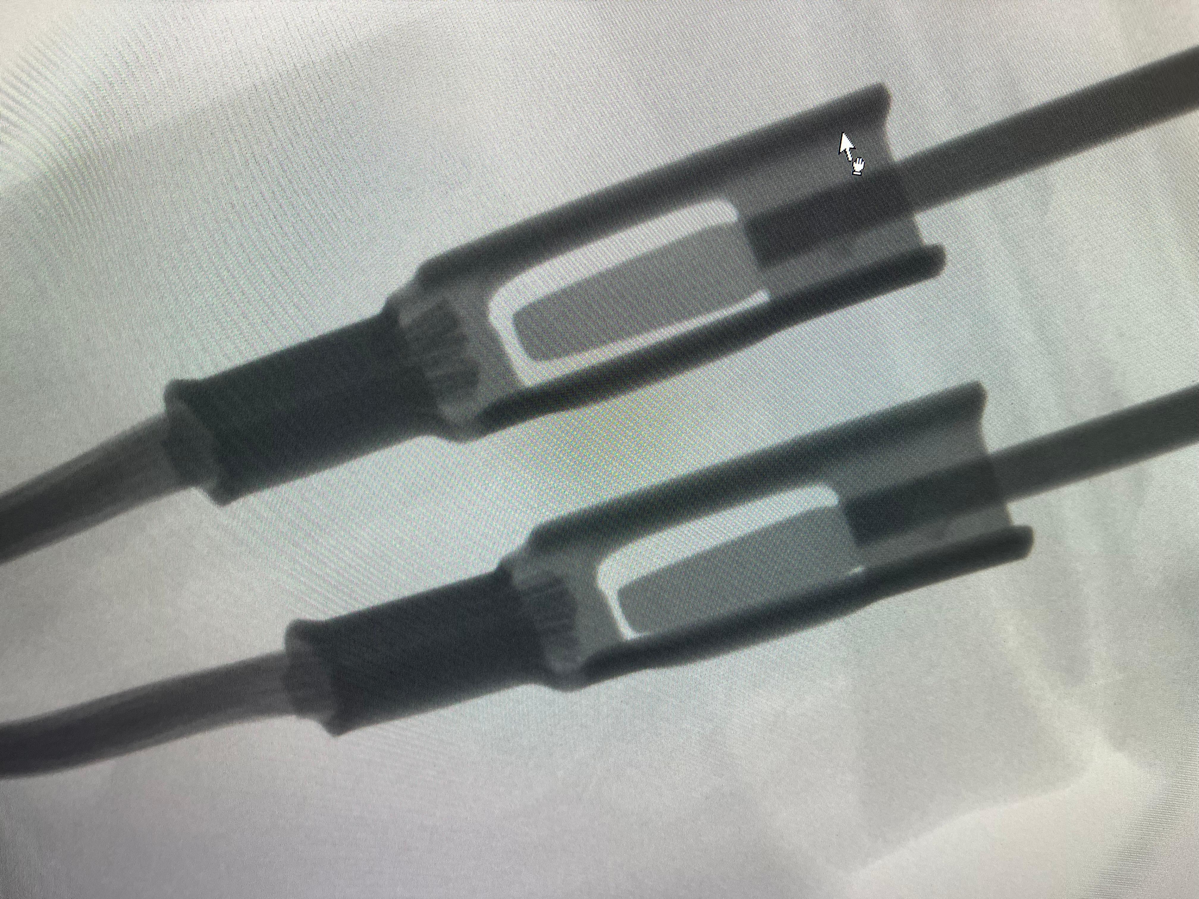 Frage zum Radsensor/ABS-Sensor vorne rechts beim S204