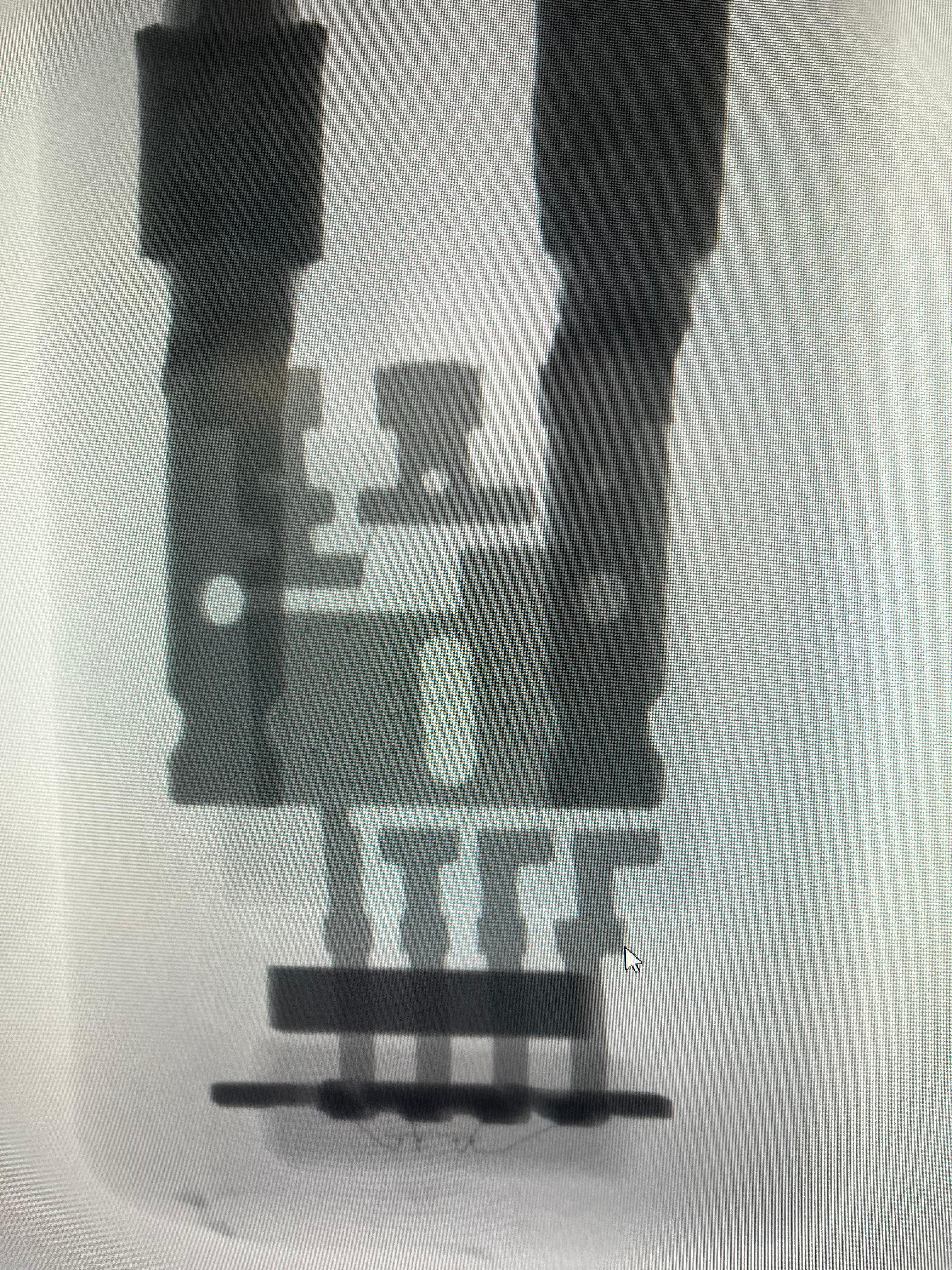Frage zum Radsensor/ABS-Sensor vorne rechts beim S204