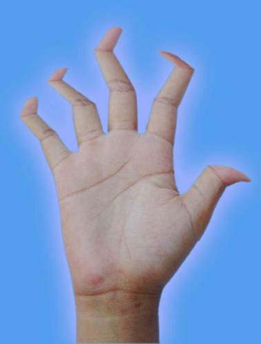 Winkelfinger