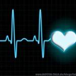 EKG
