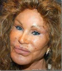 Jocelyn-wildenstein2
