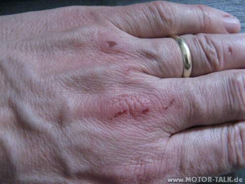 Laedierte-linke-hand