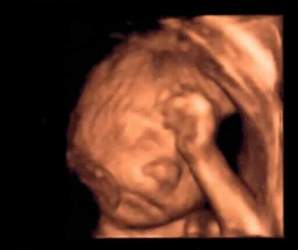 Gruebelt fleissig: Baby Namenlos
