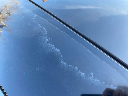 Sonnenbrand