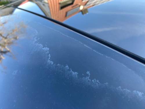 Sonnenbrand