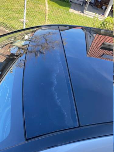 Sonnenbrand