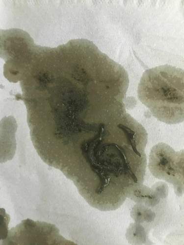 Dichtungsreste-und-spaene-aus-dem-oelsieb